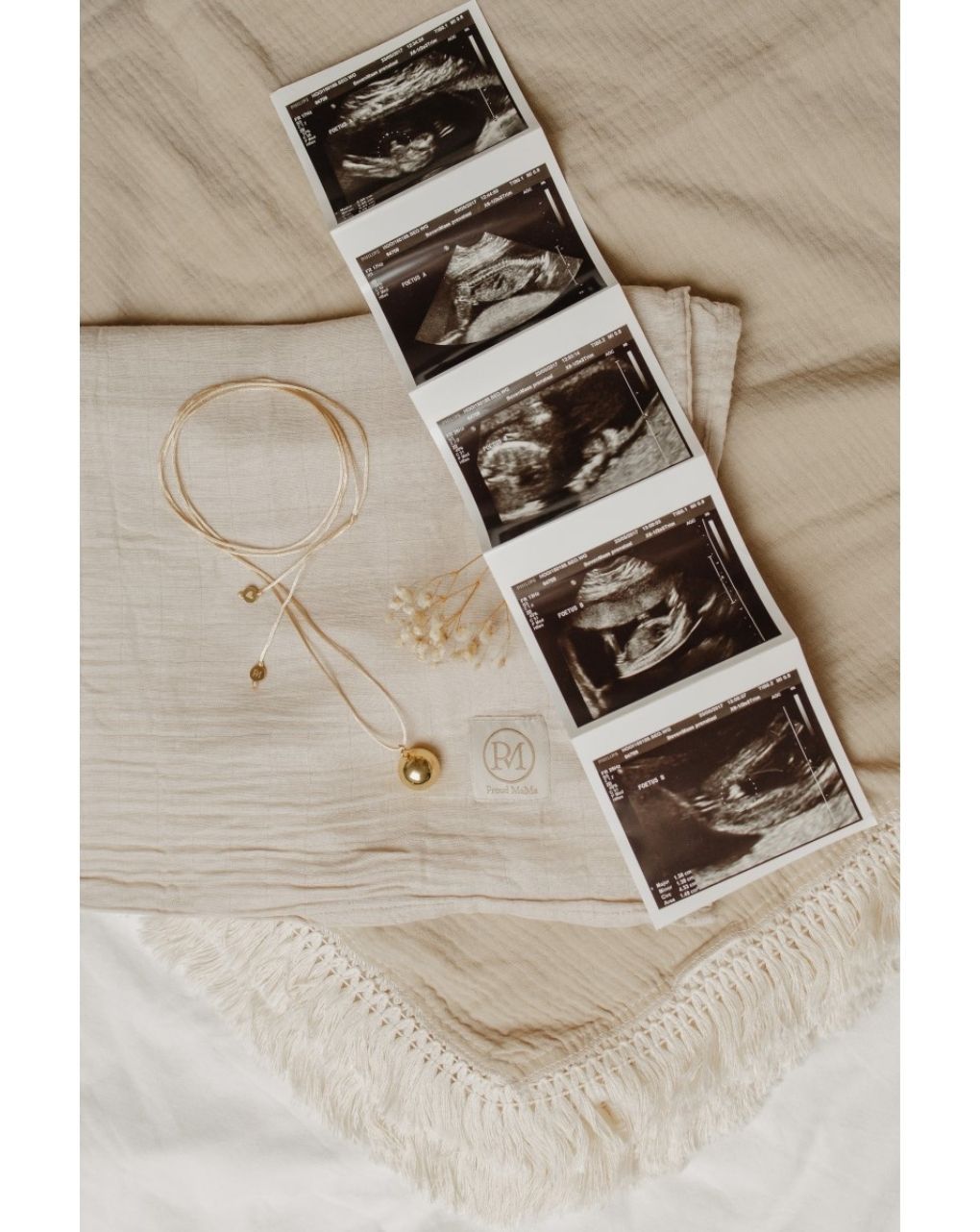 Proud mama μενταγιόν bola sofie gold pm-672 - Proud Mama